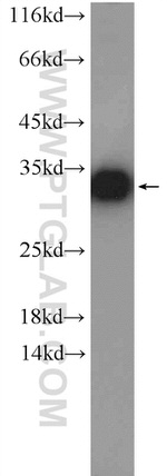 GNMT Antibody in Western Blot (WB)