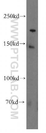 PDS5B Antibody in Western Blot (WB)