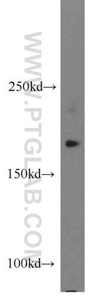 PPP1R9A Antibody in Western Blot (WB)
