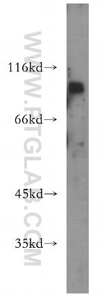 INTS8 Antibody in Western Blot (WB)
