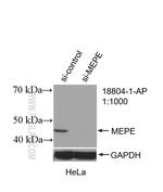 MEPE Antibody in Western Blot (WB)