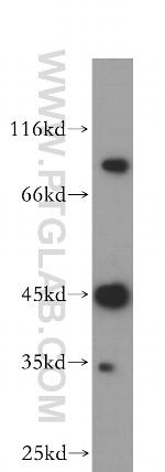 MEPE Antibody in Western Blot (WB)