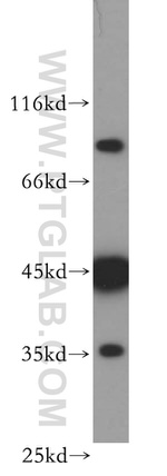 MEPE Antibody in Western Blot (WB)