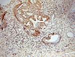 GCHFR Antibody in Immunohistochemistry (Paraffin) (IHC (P))