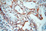 GCHFR Antibody in Immunohistochemistry (Paraffin) (IHC (P))