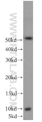 GCHFR Antibody in Western Blot (WB)