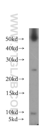 GCHFR Antibody in Western Blot (WB)