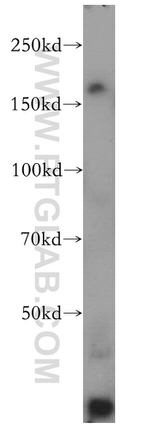 INO80 Antibody in Western Blot (WB)