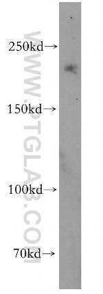 INO80 Antibody in Western Blot (WB)