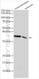ITLN2 Antibody in Western Blot (WB)