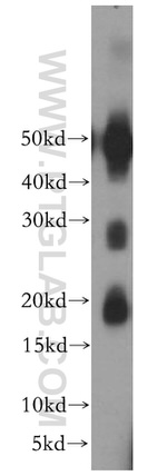 RAB41 Antibody in Western Blot (WB)
