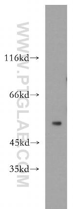 GPR142 Antibody in Western Blot (WB)