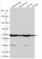 ADRA1D Antibody in Western Blot (WB)