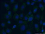 MYO16 Antibody in Immunocytochemistry (ICC/IF)