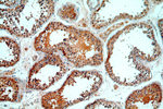 MYO16 Antibody in Immunohistochemistry (Paraffin) (IHC (P))