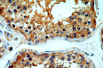 MYO16 Antibody in Immunohistochemistry (Paraffin) (IHC (P))