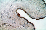 MYO16 Antibody in Immunohistochemistry (Paraffin) (IHC (P))