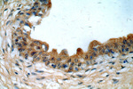 MYO16 Antibody in Immunohistochemistry (Paraffin) (IHC (P))
