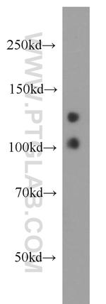 MYO16 Antibody in Western Blot (WB)
