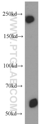 MYO16 Antibody in Western Blot (WB)