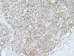 CEP192 Antibody in Immunohistochemistry (Paraffin) (IHC (P))