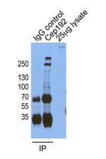 CEP192 Antibody in Immunoprecipitation (IP)