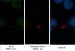 KIF27 Antibody in Immunocytochemistry (ICC/IF)
