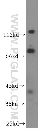 ARHGAP24 Antibody in Western Blot (WB)