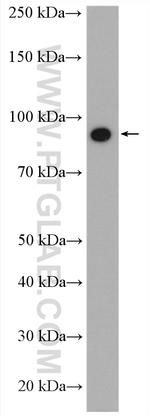 CD36 Antibody in Western Blot (WB)