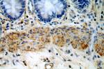 HMCN1 Antibody in Immunohistochemistry (Paraffin) (IHC (P))