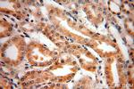CIB4 Antibody in Immunohistochemistry (Paraffin) (IHC (P))