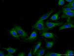 DNAH2 Antibody in Immunocytochemistry (ICC/IF)