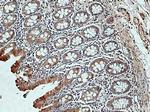 DNAH2 Antibody in Immunohistochemistry (Paraffin) (IHC (P))