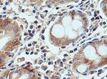 DNAH2 Antibody in Immunohistochemistry (Paraffin) (IHC (P))