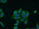 RAB12 Antibody in Immunocytochemistry (ICC/IF)