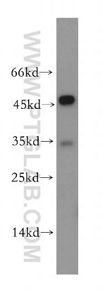 VN1R4 Antibody in Western Blot (WB)
