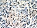 UBR2 Antibody in Immunohistochemistry (Paraffin) (IHC (P))