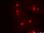 UTP3 Antibody in Immunocytochemistry (ICC/IF)
