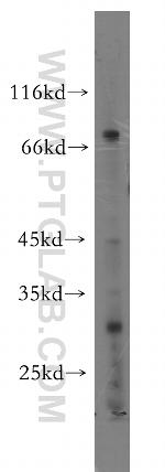 UTP3 Antibody in Western Blot (WB)