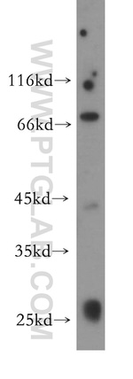UTP3 Antibody in Western Blot (WB)