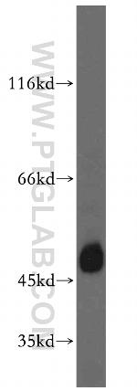 TEX13A Antibody in Western Blot (WB)