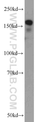 RBM16 Antibody in Western Blot (WB)