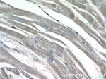 LAPTM4B Antibody in Immunohistochemistry (Paraffin) (IHC (P))
