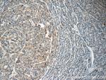 LAPTM4B Antibody in Immunohistochemistry (Paraffin) (IHC (P))