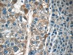 LAPTM4B Antibody in Immunohistochemistry (Paraffin) (IHC (P))