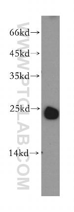 LAPTM4B Antibody in Western Blot (WB)