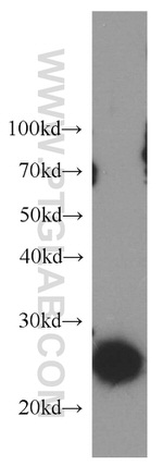 LAPTM4B Antibody in Western Blot (WB)