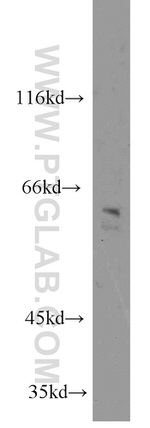 NEURL Antibody in Western Blot (WB)