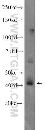 CEP170/CEP170L Antibody in Western Blot (WB)