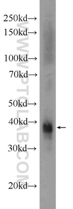 CEP170/CEP170L Antibody in Western Blot (WB)